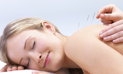 Coquitlam Acupuncture