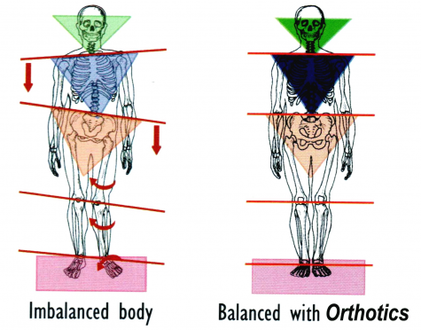 Custom foot orthotics balances the body at Apex Chiropractic Coquitlam