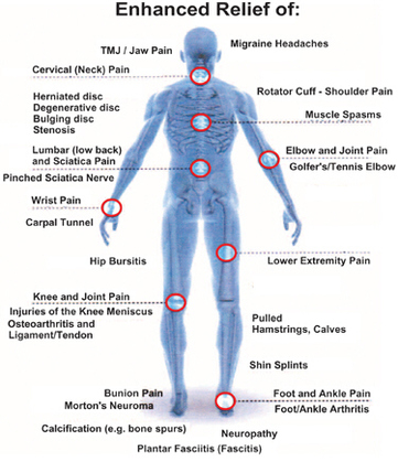 Deep tissue laser therapy can treat many conditions.